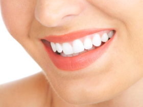 5 Tips to brighten smile