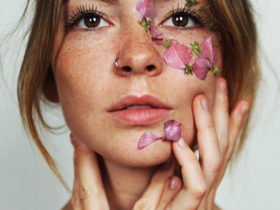 Radiesse Dermal Filler