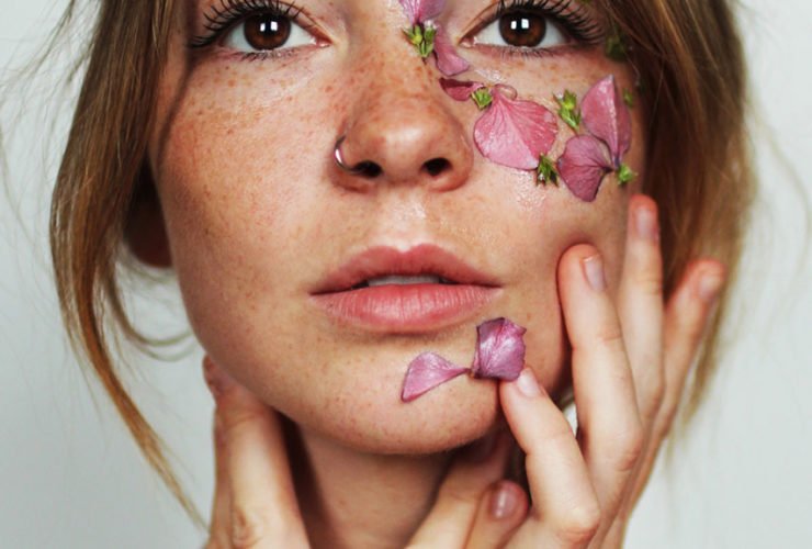 Radiesse Dermal Filler