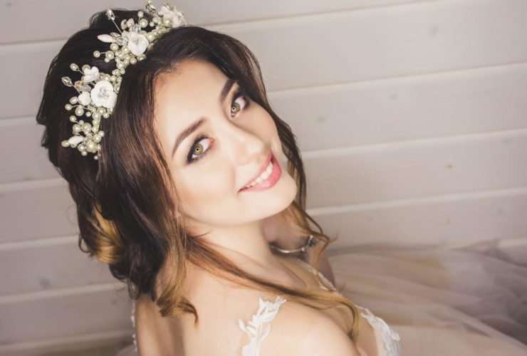 Dazzling Smile for Your Wedding