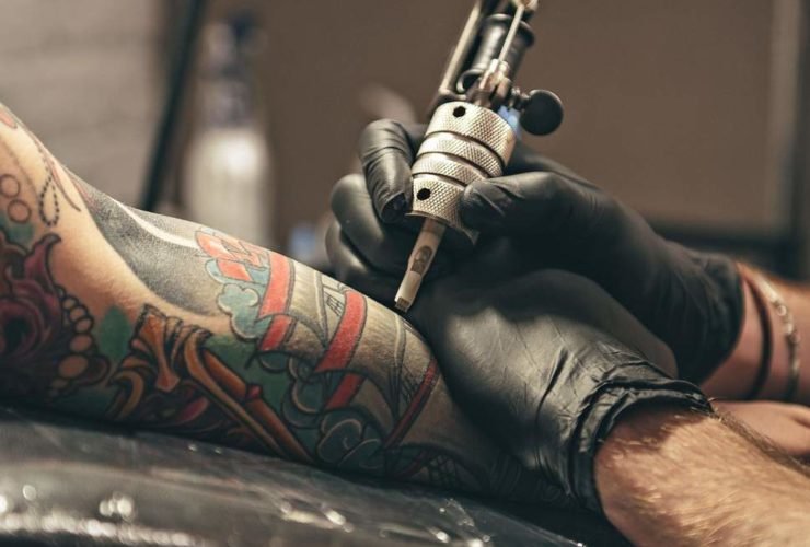 Common Tattoo Removal Questions & Answers