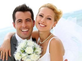 Brighter Smile for Wedding